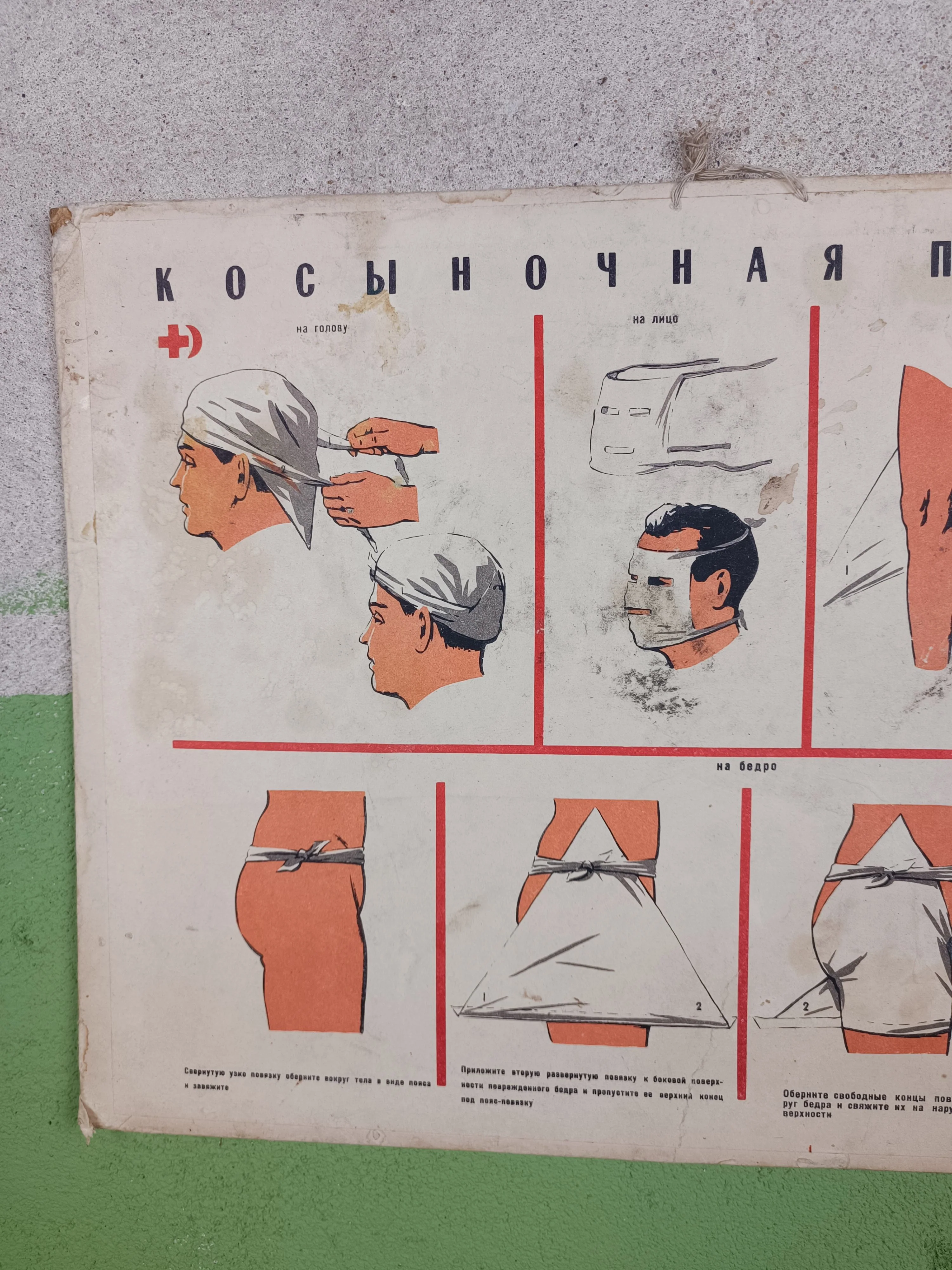 Double Sided Medical Poster. "Косыночрая Повязка/ Bandaging" - Image 3
